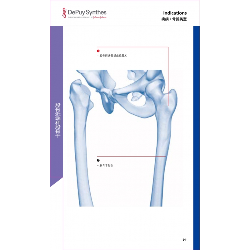 Proximal femur and femoral shaft 1
