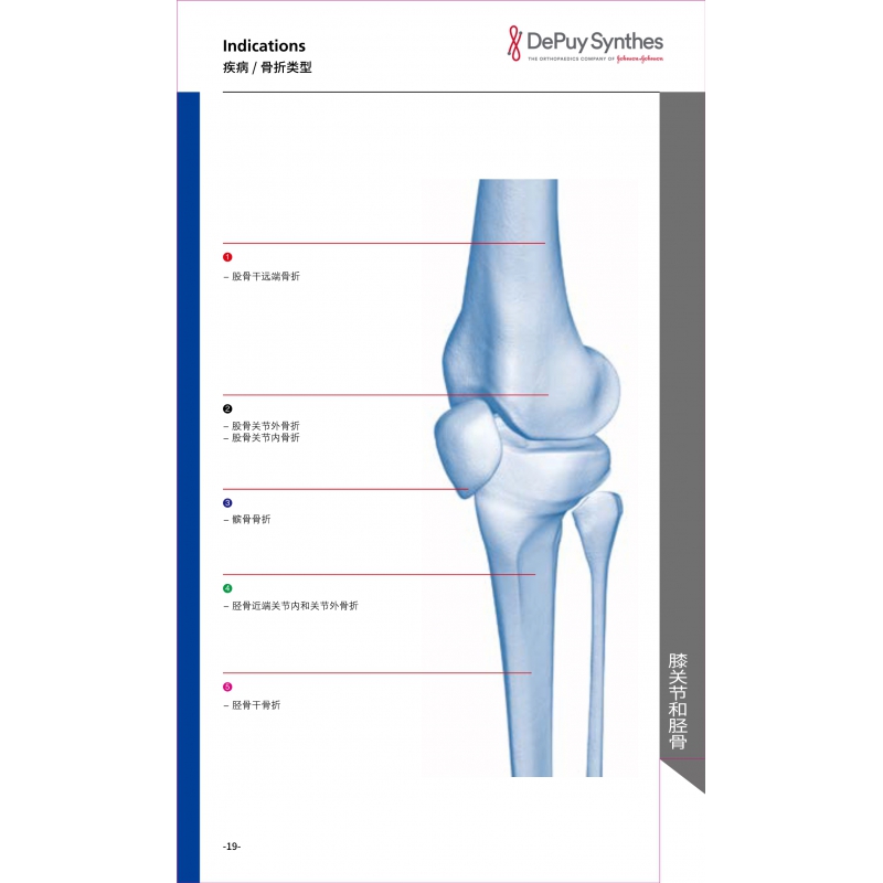 Knee joint and tibia 1