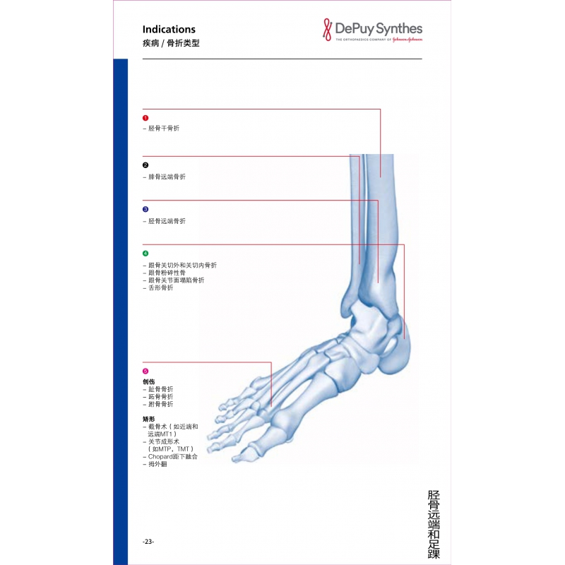 Distal tibia and foot 1
