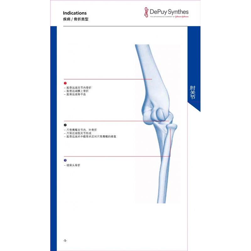 Elbow joint 1